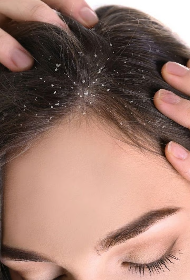 Medical Scalp Treatment