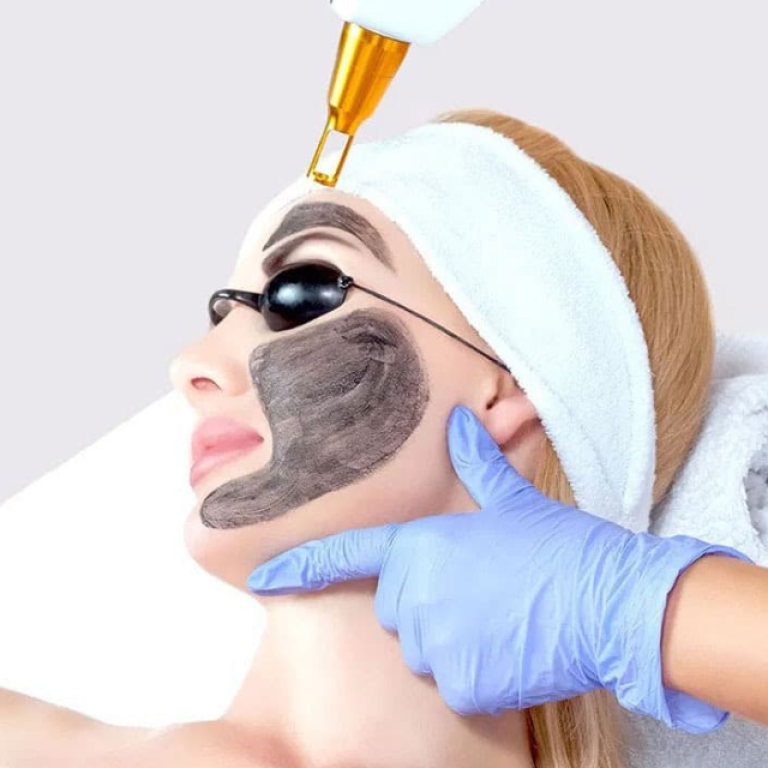 Benefits of hollywood Facial