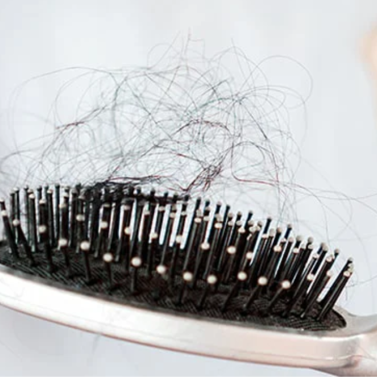 What Is Hair Loss Prevention